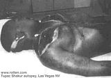 Tupac+autopsy+pic